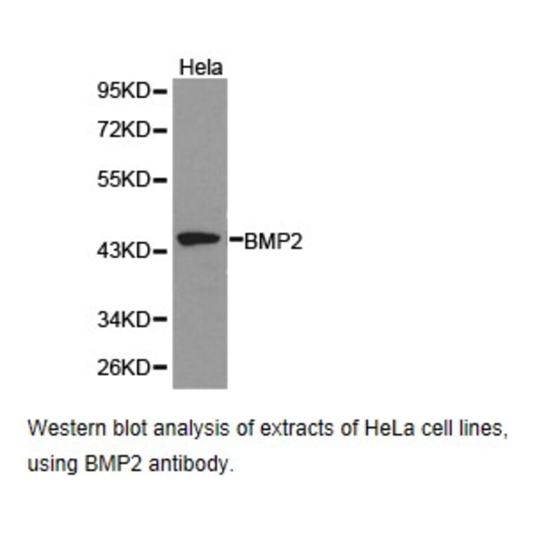Anti-BMP2 Antibody from Bioworld Technology (BS6815) - Antibodies.com