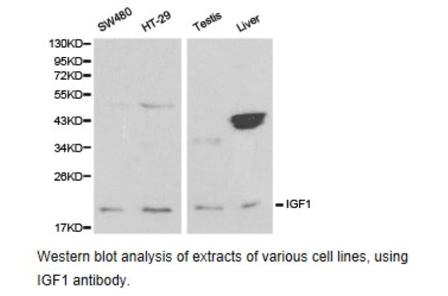 Anti-IGF-1 Antibody from Bioworld Technology (BS6817) - Antibodies.com