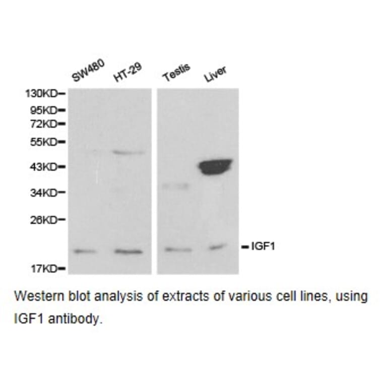 Anti-IGF-1 Antibody from Bioworld Technology (BS6817) - Antibodies.com