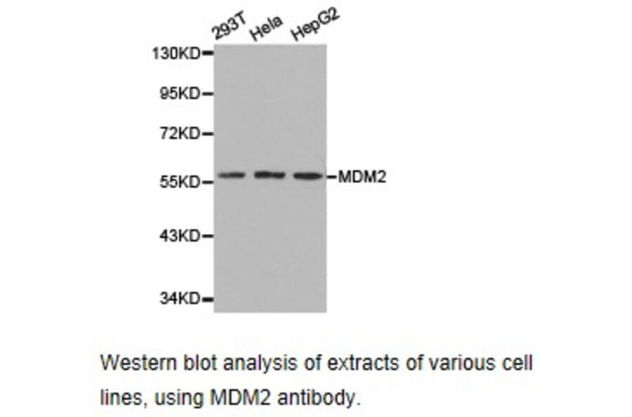 Anti-MDM2 Antibody from Bioworld Technology (BS6818) - Antibodies.com