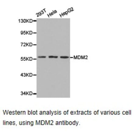 Anti-MDM2 Antibody from Bioworld Technology (BS6818) - Antibodies.com