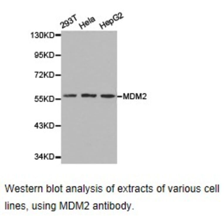 Anti-MDM2 Antibody from Bioworld Technology (BS6818) - Antibodies.com