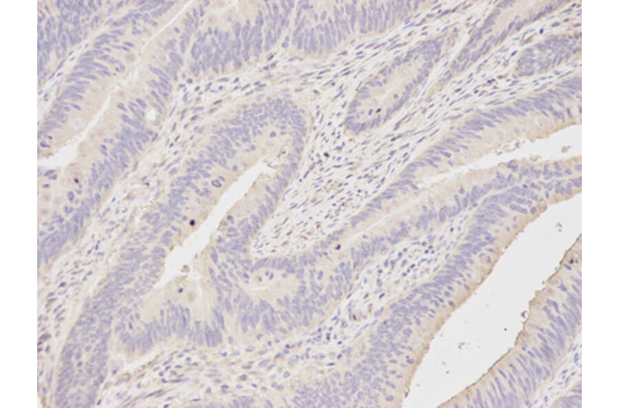 Anti-DDX58 Antibody from Bioworld Technology (BS6819) - Antibodies.com