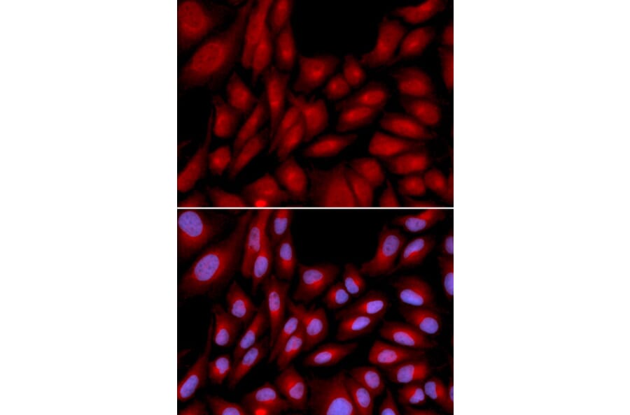 Anti-BAG1 Antibody from Bioworld Technology (BS6821) - Antibodies.com
