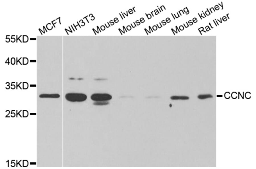 Anti-CCNC Antibody from Bioworld Technology (BS6824) - Antibodies.com