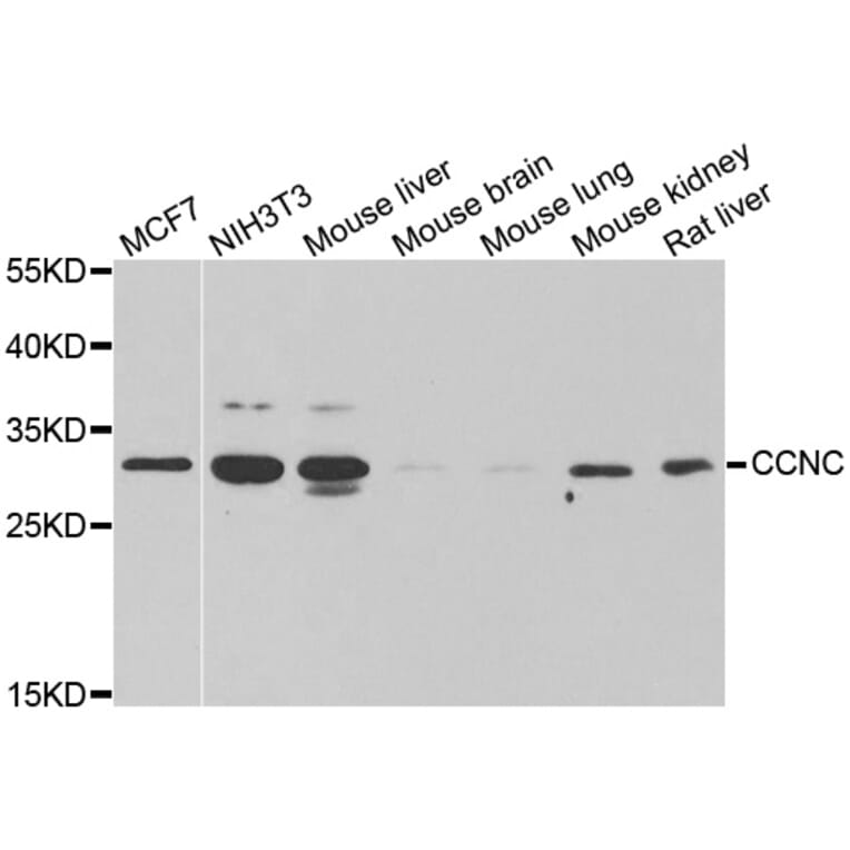 Anti-CCNC Antibody from Bioworld Technology (BS6824) - Antibodies.com