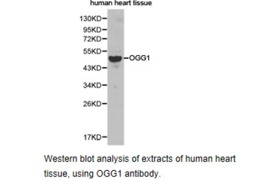 Anti-OGG1 Antibody from Bioworld Technology (BS6826) - Antibodies.com