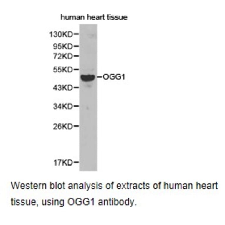 Anti-OGG1 Antibody from Bioworld Technology (BS6826) - Antibodies.com