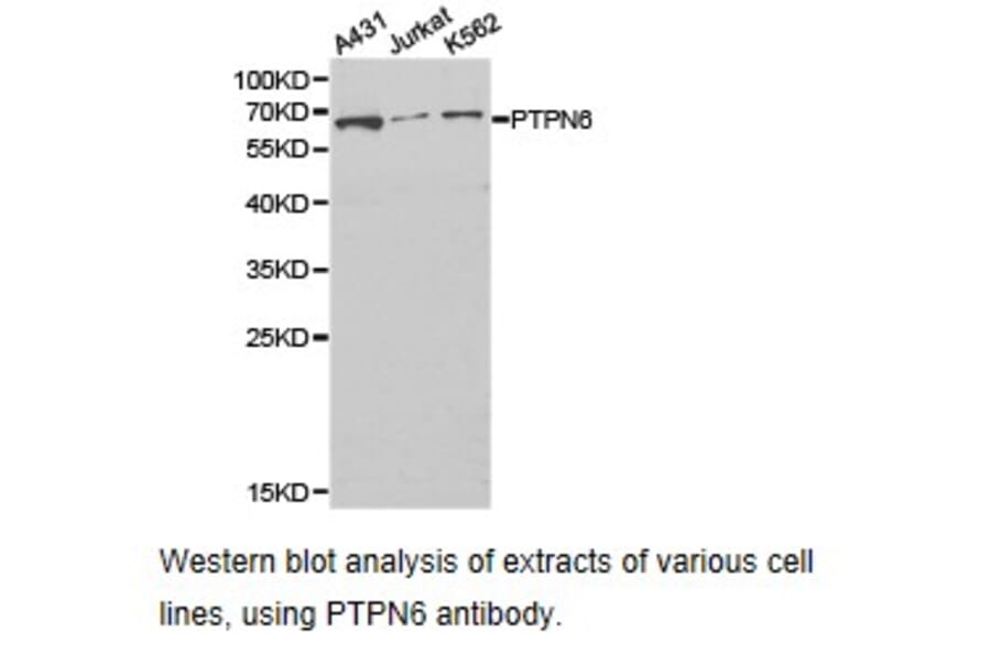 Anti-SHP-1 Antibody from Bioworld Technology (BS6827) - Antibodies.com