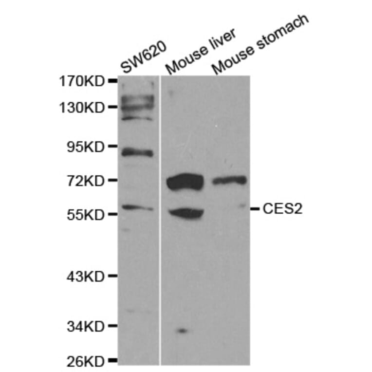 Anti-CES2 Antibody from Bioworld Technology (BS6829) - Antibodies.com