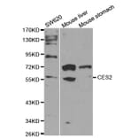 Anti-CES2 Antibody from Bioworld Technology (BS6829) - Antibodies.com