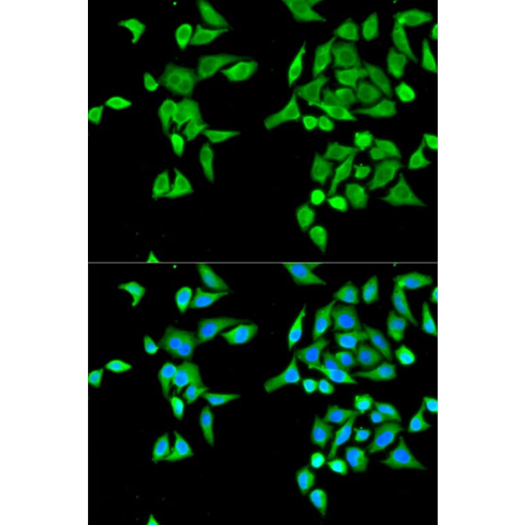 Anti-CES2 Antibody from Bioworld Technology (BS6829) - Antibodies.com