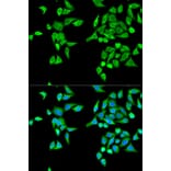 Anti-CES2 Antibody from Bioworld Technology (BS6829) - Antibodies.com