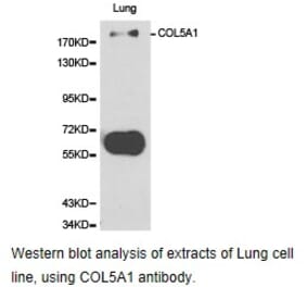 Anti-COL5A1 Antibody from Bioworld Technology (BS6830) - Antibodies.com