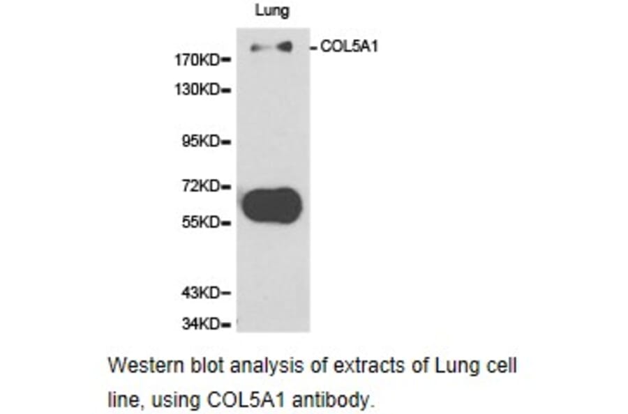 Anti-COL5A1 Antibody from Bioworld Technology (BS6830) - Antibodies.com