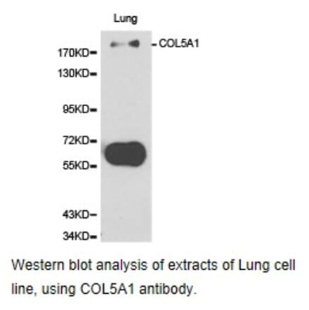 Anti-COL5A1 Antibody from Bioworld Technology (BS6830) - Antibodies.com