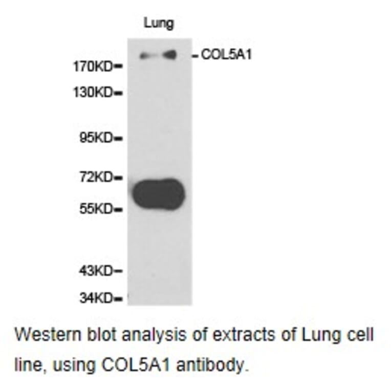 Anti-COL5A1 Antibody from Bioworld Technology (BS6830) - Antibodies.com