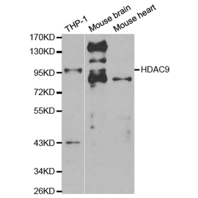 Anti-HDAC 9 Antibody from Bioworld Technology (BS6831) - Antibodies.com