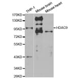 Anti-HDAC 9 Antibody from Bioworld Technology (BS6831) - Antibodies.com