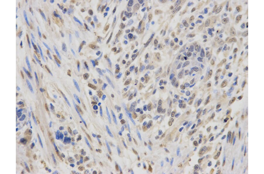 Anti-IGF2BP1 Antibody from Bioworld Technology (BS6832) - Antibodies.com