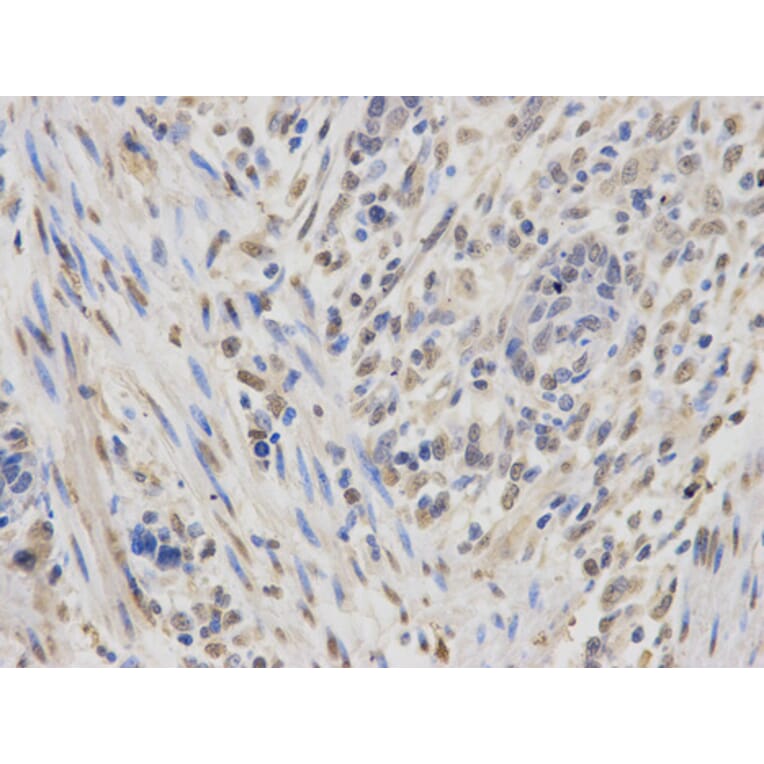 Anti-IGF2BP1 Antibody from Bioworld Technology (BS6832) - Antibodies.com