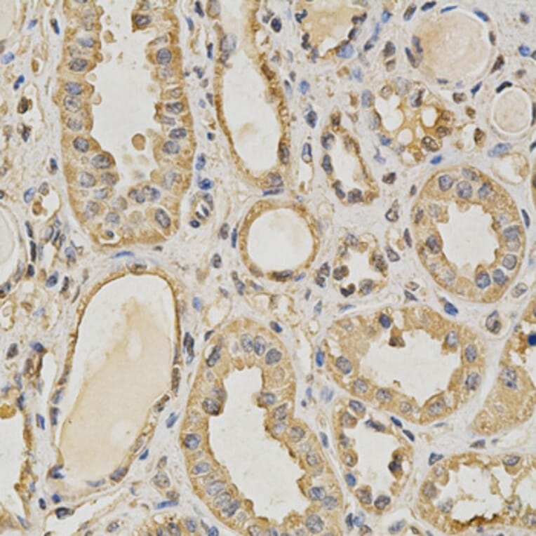 Anti-PRMT5 Antibody from Bioworld Technology (BS6835) - Antibodies.com
