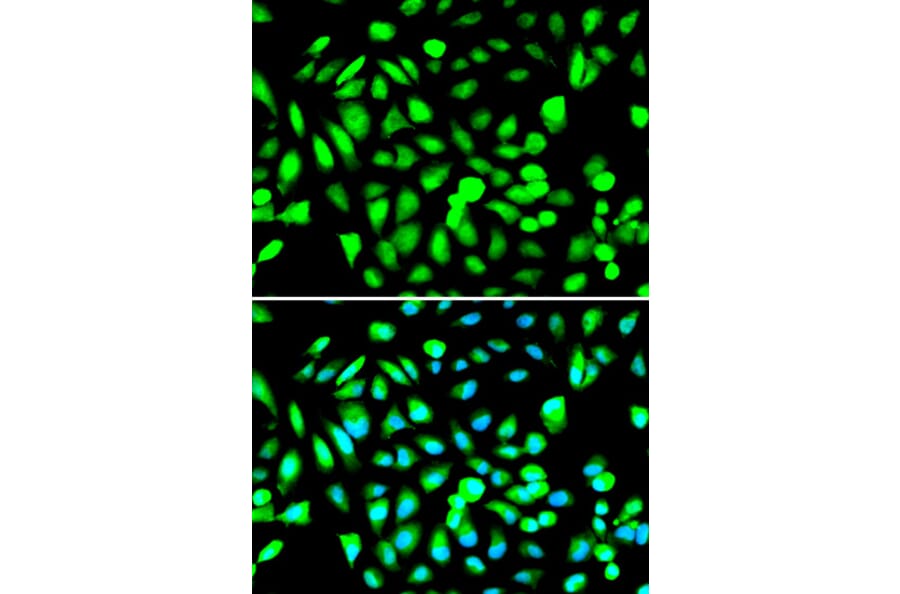 Anti-PRMT5 Antibody from Bioworld Technology (BS6835) - Antibodies.com
