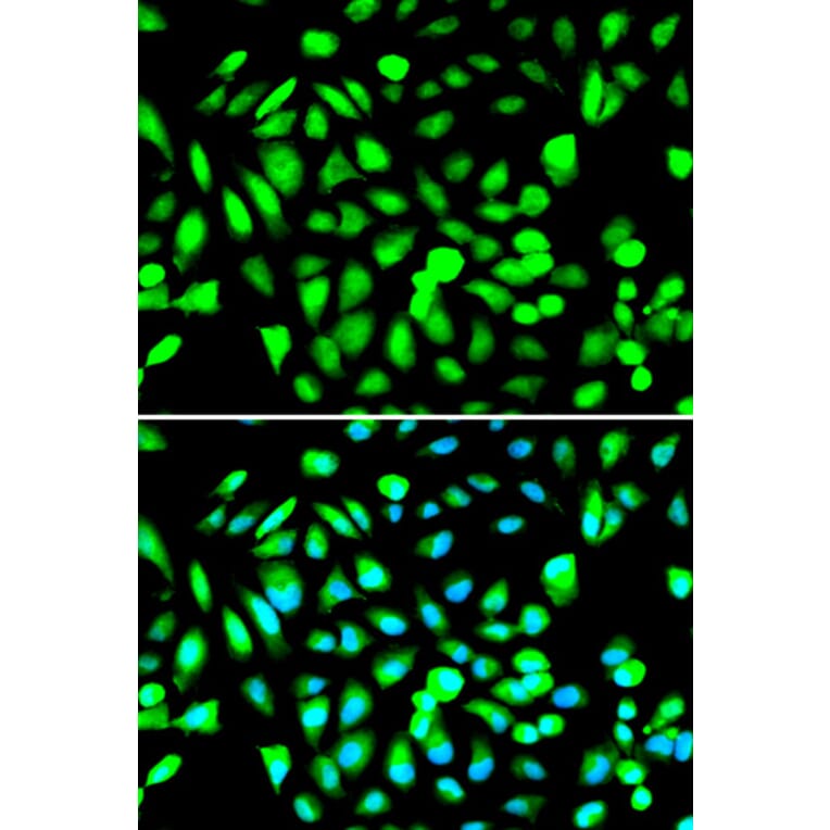 Anti-PRMT5 Antibody from Bioworld Technology (BS6835) - Antibodies.com