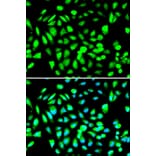 Anti-PRMT5 Antibody from Bioworld Technology (BS6835) - Antibodies.com