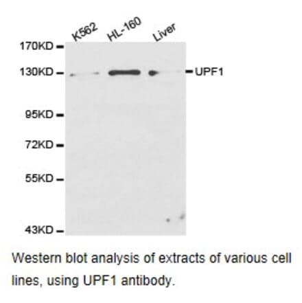 Anti-UPF1 Antibody from Bioworld Technology (BS6836) - Antibodies.com