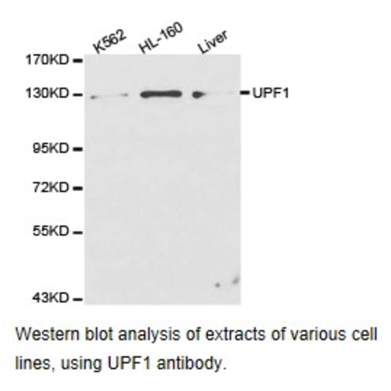 Anti-UPF1 Antibody from Bioworld Technology (BS6836) - Antibodies.com