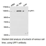 Anti-UPF1 Antibody from Bioworld Technology (BS6836) - Antibodies.com