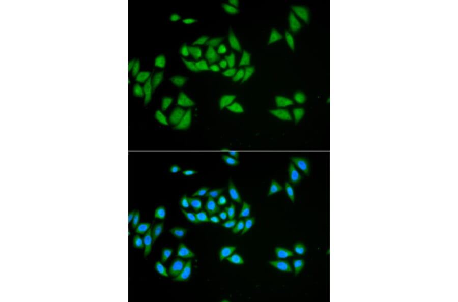 Anti-UPF1 Antibody from Bioworld Technology (BS6836) - Antibodies.com