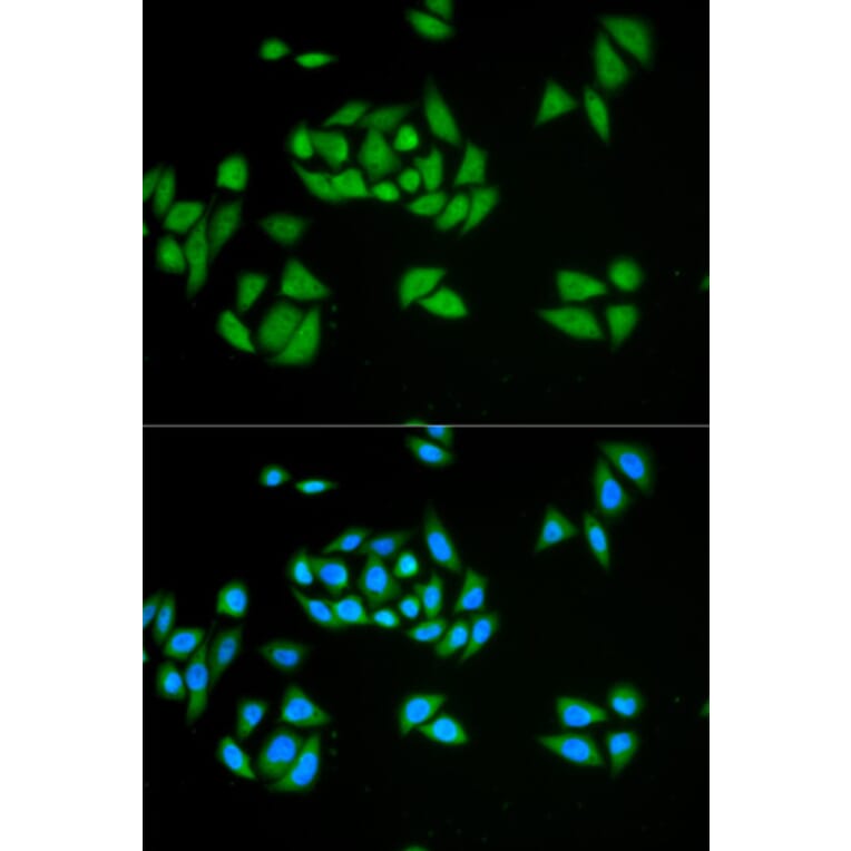 Anti-UPF1 Antibody from Bioworld Technology (BS6836) - Antibodies.com