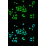Anti-UPF1 Antibody from Bioworld Technology (BS6836) - Antibodies.com