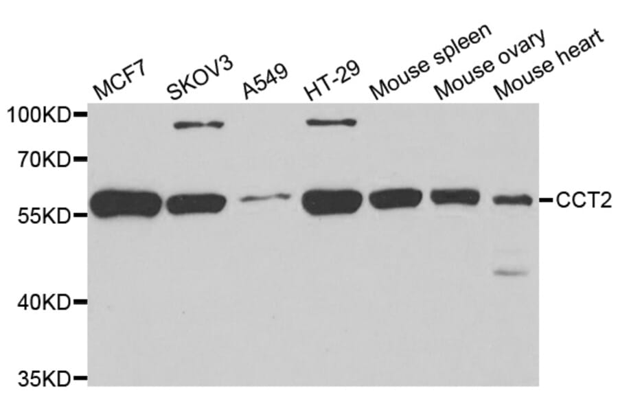 Anti-CCT2 Antibody from Bioworld Technology (BS6838) - Antibodies.com