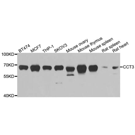 Anti-CCT3 Antibody from Bioworld Technology (BS6839) - Antibodies.com