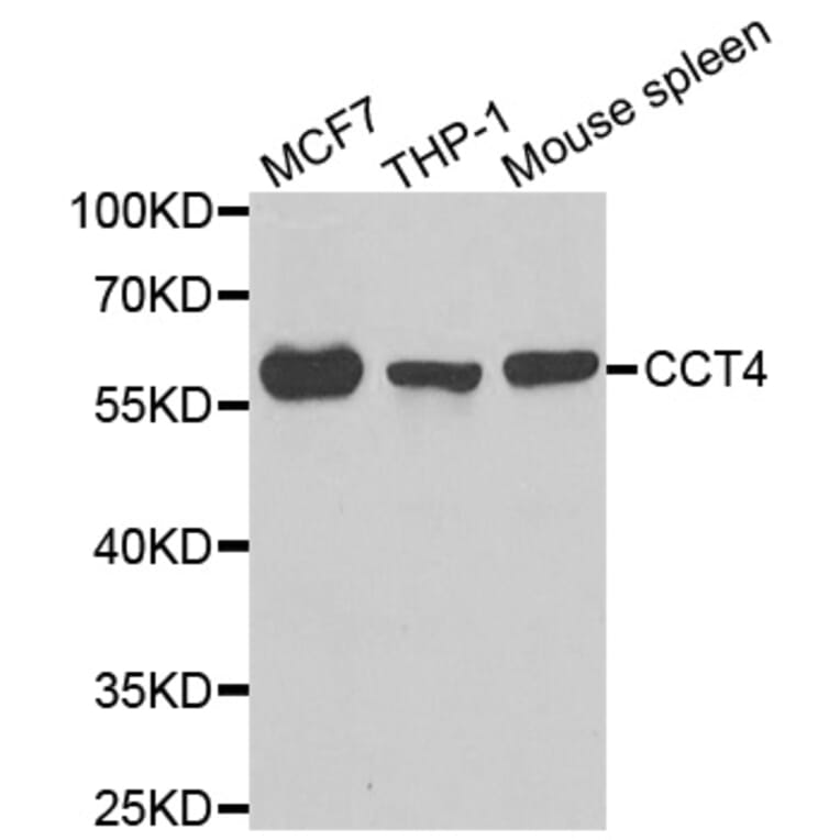 Anti-CCT4 Antibody from Bioworld Technology (BS6841) - Antibodies.com