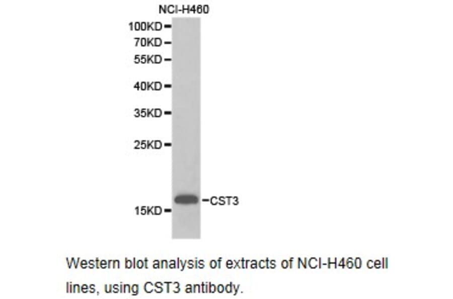 Anti-Cystatin C Antibody from Bioworld Technology (BS6842) - Antibodies.com