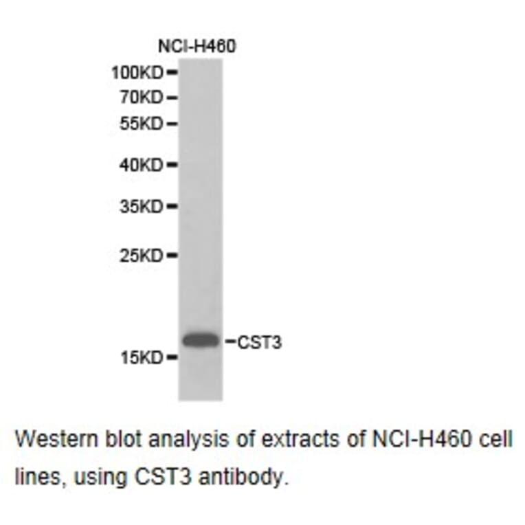 Anti-Cystatin C Antibody from Bioworld Technology (BS6842) - Antibodies.com