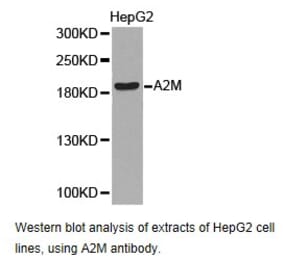 Anti-A2M Antibody from Bioworld Technology (BS6844) - Antibodies.com