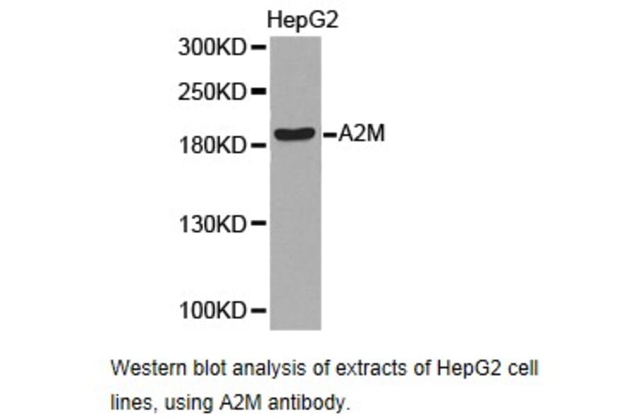 Anti-A2M Antibody from Bioworld Technology (BS6844) - Antibodies.com