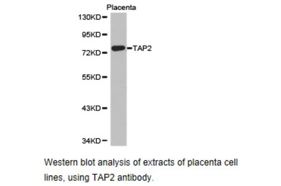 Anti-TAP2 Antibody from Bioworld Technology (BS6846) - Antibodies.com