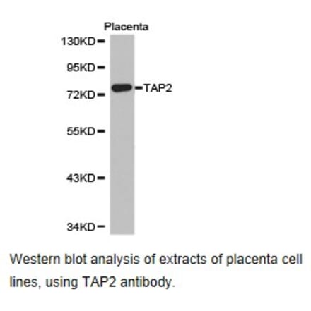 Anti-TAP2 Antibody from Bioworld Technology (BS6846) - Antibodies.com