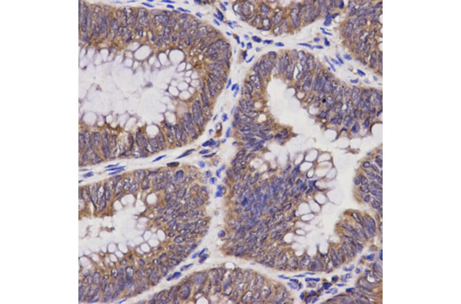 Anti-TAP2 Antibody from Bioworld Technology (BS6846) - Antibodies.com
