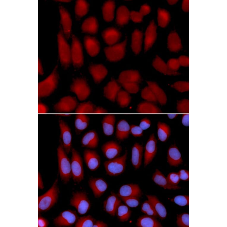 Anti-TAP2 Antibody from Bioworld Technology (BS6846) - Antibodies.com