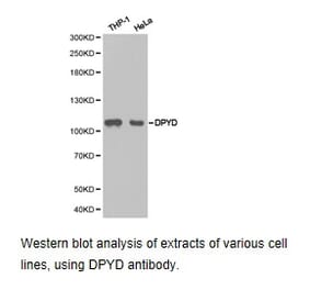 Anti-DPYD Antibody from Bioworld Technology (BS6847) - Antibodies.com