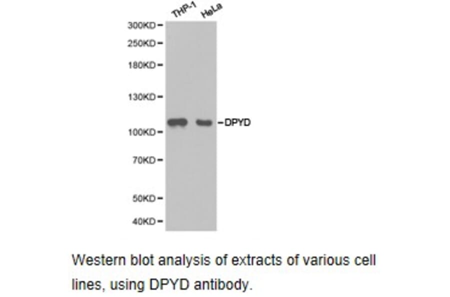 Anti-DPYD Antibody from Bioworld Technology (BS6847) - Antibodies.com