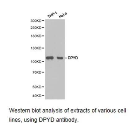 Anti-DPYD Antibody from Bioworld Technology (BS6847) - Antibodies.com