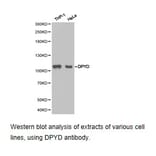 Anti-DPYD Antibody from Bioworld Technology (BS6847) - Antibodies.com